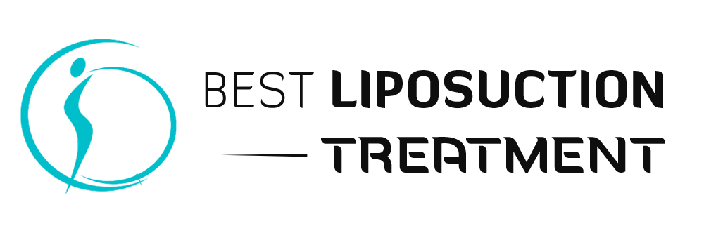 Best Liposuction Treatment